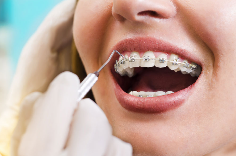 periodontoloji